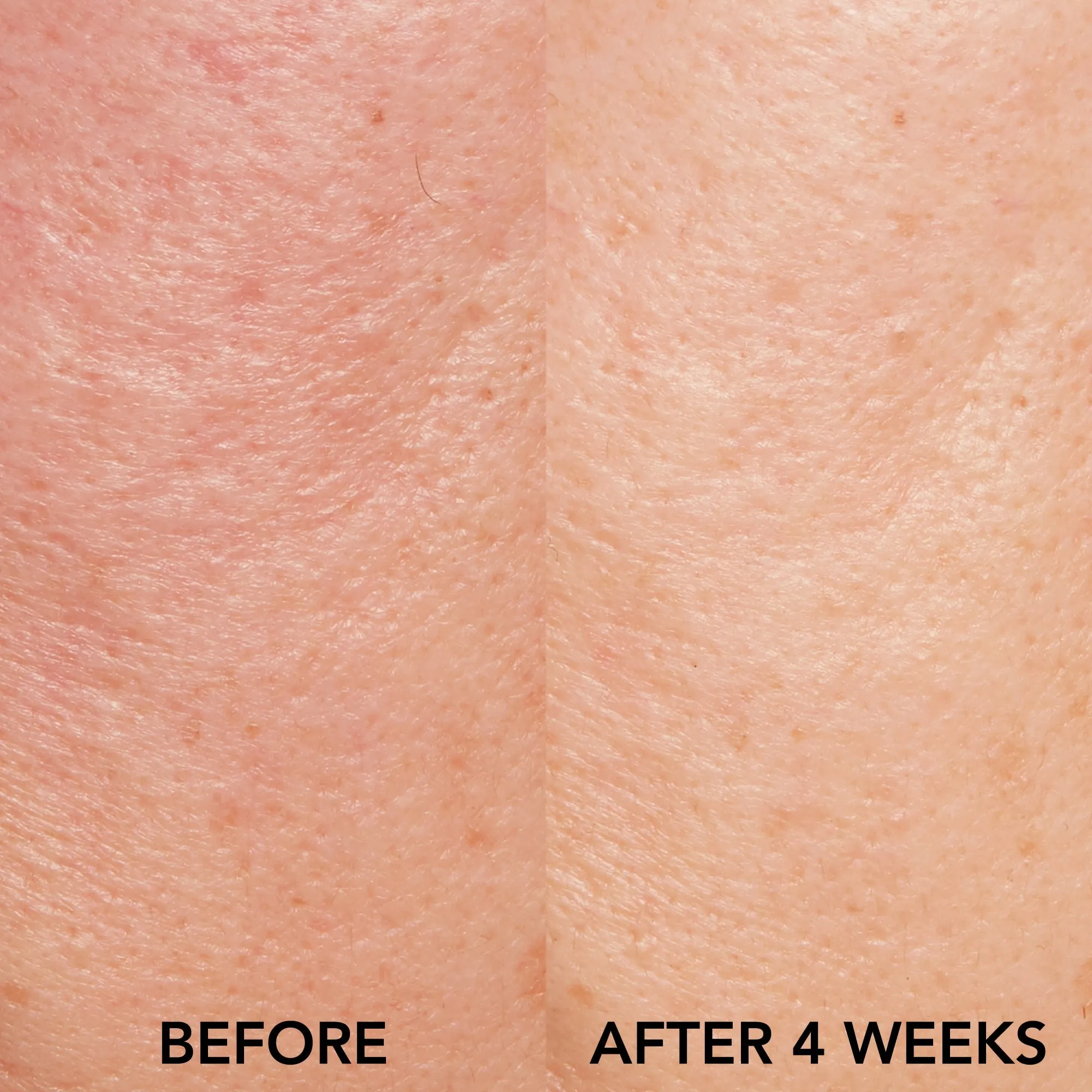 Retexturizing Treatment